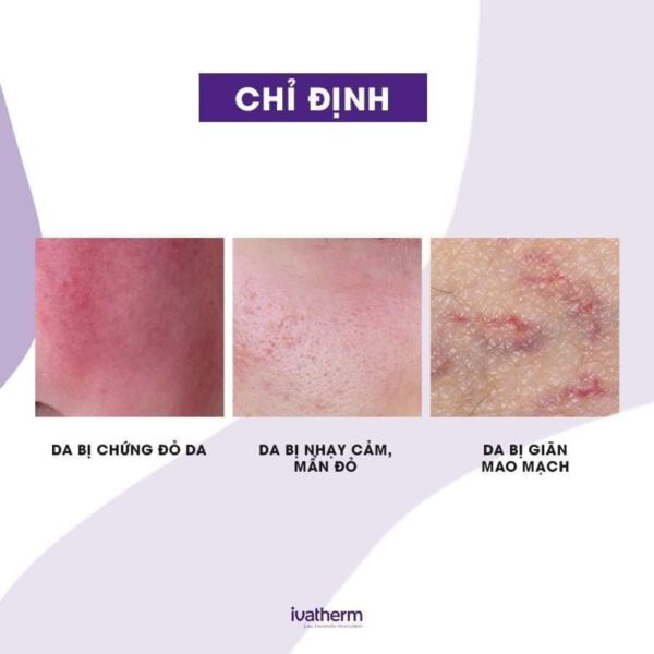 kem dưỡng da giảm mẩn đỏ, kích ứng rosederm cream ivatherm